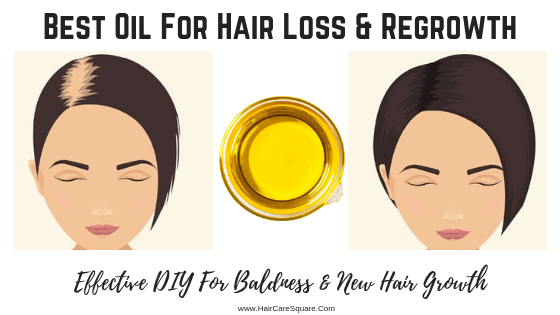 Best Hair Regrowth Oil With Just 3 Ingredients: Remedy For Hair Loss